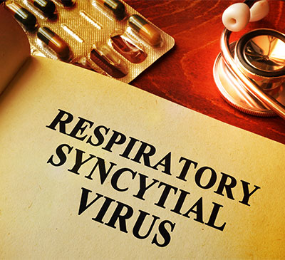 Respiratory Syncytial Virus Diagnostics Market by Product and Geography - Forecast and Analysis 2020-2024